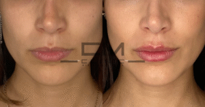 hidratacion de labios adrover fr