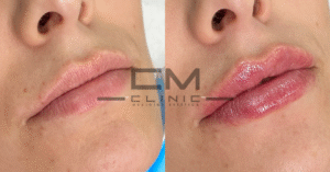 hidratacion de labios blanco nuin fr