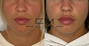 hidratación de Labios victoria rodríguez