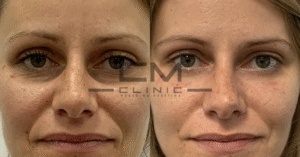 ojeras laura guardiola fr