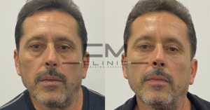 Ojeras stefan tudorica fr